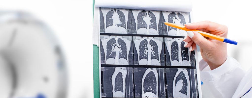 A doctor points to a series of CT scans.