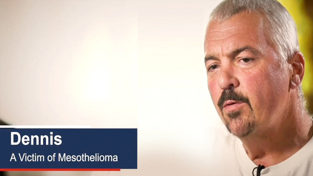Testimonial of Dennis a mesothelioma victim