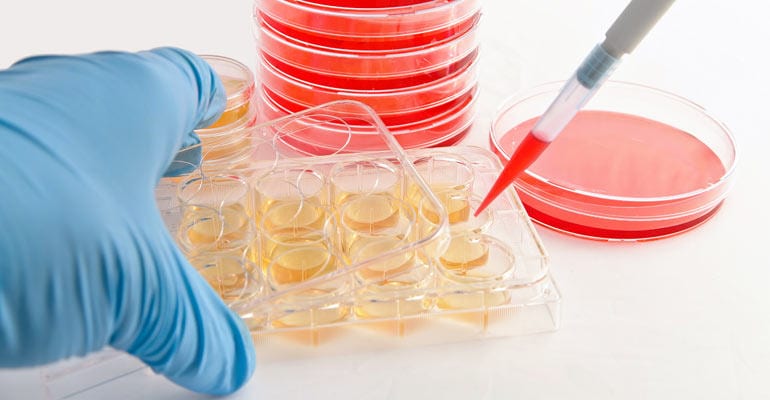 Enhancing Mesothelioma Research with Primary Cell Lines