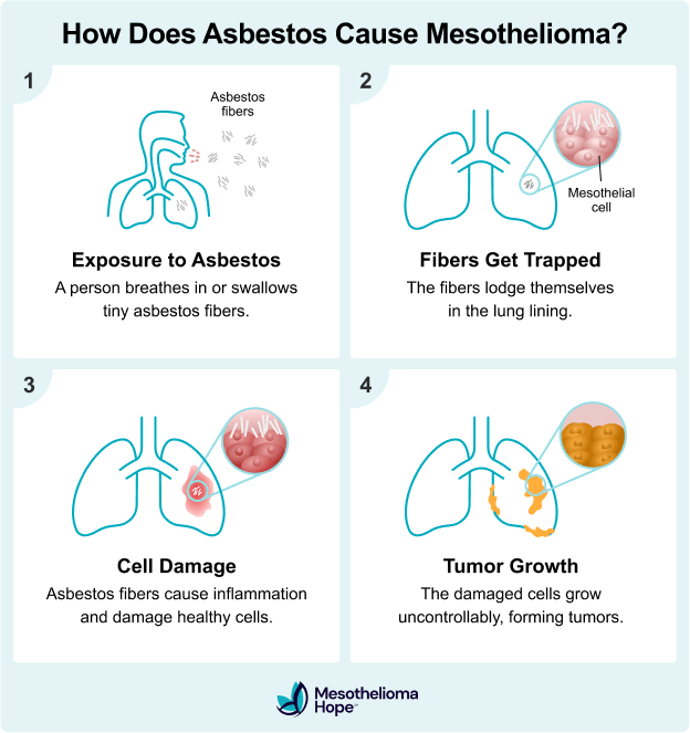 Infographic showing how asbestos causes mesothelioma